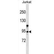 Zinc Finger MYM-Type Protein 6 (ZMYM6) Antibody
