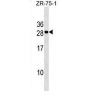 C-Type Lectin Domain Family 9 Member A (CLEC9A) Antibody