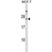 Cytochrome B5 Domain Containing 1 (CYB5D1) Antibody