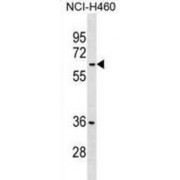 Putative Malate Dehydrogenase 1B (MDH1B) Antibody