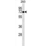 OTOP2 Antibody