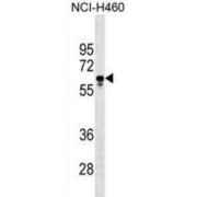 Phosphatidylglycerophosphate Synthase 1 (PGS1) Antibody