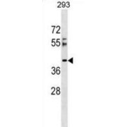 RSRC2 Antibody