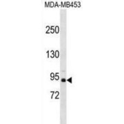 Zinc Finger And BTB Domain-Containing Protein 49 (ZBTB49) Antibody