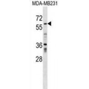 Zinc Finger Protein 543 (ZNF543) Antibody