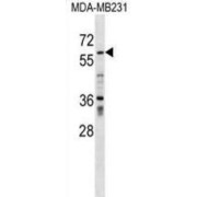 Zinc Finger Protein 543 (ZNF543) Antibody