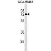 Zinc Finger Protein 57 (ZNF57) Antibody
