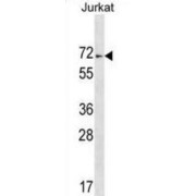 Zinc Finger Protein 613 (ZNF613) Antibody