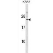 Dephospho-CoA Kinase Domain Containing (DCAKD) Antibody