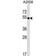 Solute Carrier Family 9 Member B2 (NHEDC2) Antibody