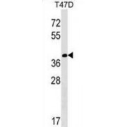 Protein N-Terminal Asparagine Amidohydrolase (NTAN1) Antibody