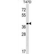 Protein N-Terminal Asparagine Amidohydrolase (NTAN1) Antibody