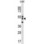 RMD2 Antibody