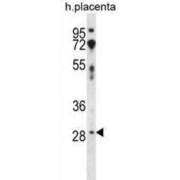 OX-2 Membrane Glycoprotein (CD200) Antibody