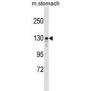 SLIT-ROBO Rho GTPase Activating Protein 1 (SRGAP1) Antibody