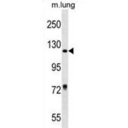 Retinol Binding Protein 3, Interstitial (RBP3) Antibody