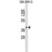 Translocating Chain-Associated Membrane Protein 1 (TRAM1) Antibody