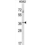 Zinc Finger Protein 385A (ZNF385A) Antibody