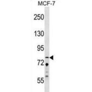 Zinc Finger Protein 828 (ZNF828) Antibody