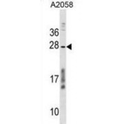 Coiled-Coil Domain-Containing Protein 144NL (CCDC144NL) Antibody