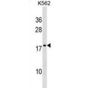 Down Regulator Of Transcription 1, TBP Binding (DR1) Antibody