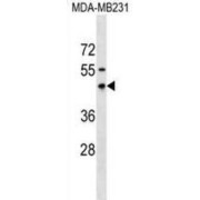E3 Ubiquitin-Protein Ligase RNFT1 (RNFT1) Antibody
