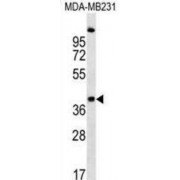 CCR4-NOT Transcription Complex Subunit 9 (RQCD1) Antibody