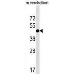 CCR4-NOT Transcription Complex Subunit 9 (RQCD1) Antibody