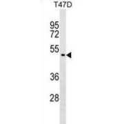 Zinc Finger Protein 557 (ZNF557) Antibody