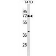 Zinc Finger Protein 563 (ZNF563) Antibody