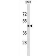 TNF Receptor Superfamily Member 5 / TNFRSF5 (CD40) Antibody