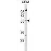 Calcitonin Gene-Related Peptide Type 1 Receptor (CALCRL) Antibody