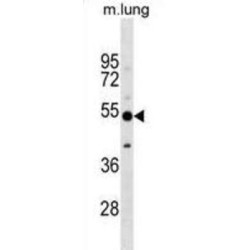 Calcitonin Gene-Related Peptide Type 1 Receptor (CALCRL) Antibody