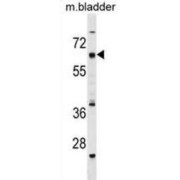 Cat Eye Syndrome Critical Region Protein 6 (CECR6) Antibody