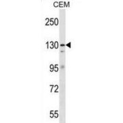 DNA Repair Protein Complementing XP-G Cells (ERCC5) Antibody