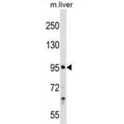 Proline And Serine-Rich Protein 1 (PROSER1) Antibody