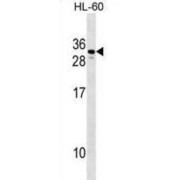 Choriogonadotropin Subunit Beta Variant 2 (CGB2) Antibody