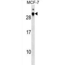 Microvascular Endothelial Differentiation Gene 1 Protein (DNAJB9) Antibody