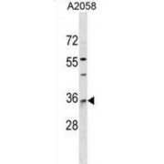 Ras-Related Protein Rab-40A (RAB40A) Antibody