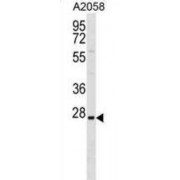 Tripartite Motif Containing 74 (TRIM74) Antibody