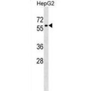 Zinc Finger Protein 419 (ZNF419) Antibody