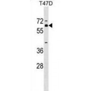 Zinc Finger Protein 554 (ZNF554) Antibody