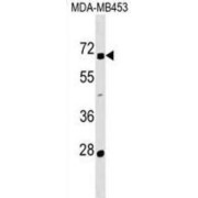 Zinc Finger Protein 565 (ZNF565) Antibody