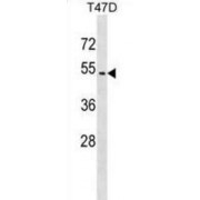 Zinc Finger Protein 713 (ZNF713) Antibody