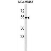 1-Aminocyclopropane-1-Carboxylate Synthase-Like Protein 1 (ACCS) Antibody