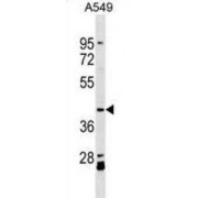 Actin Like 8 (ACTL8) Antibody
