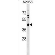 N-Acetylglucosamine-6-Phosphate Deacetylase (AMDHD2) Antibody