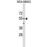 Coronin 1B (CORO1B) Antibody