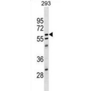 Copine-5 (CPNE5) Antibody