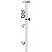 DnaJ (Hsp40) Homolog, Subfamily C, Member 5 Beta (DNAJC5B) Antibody